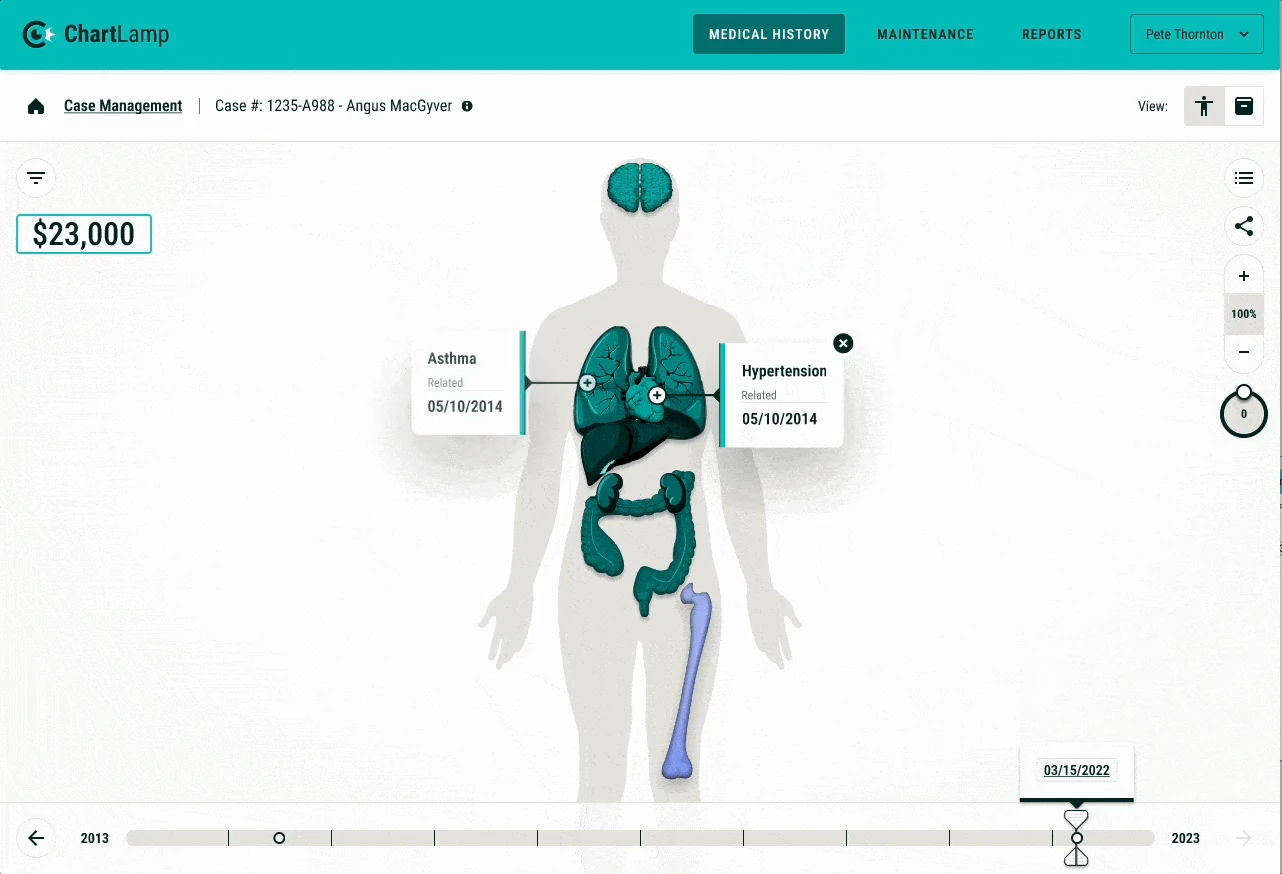 ChartLamp prototype showing an anatomical body map and medical-history timeline.